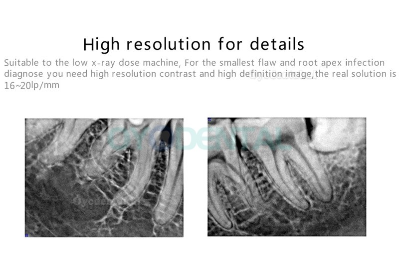 Handy HDR 500B Digitale USB-type tandheelkundige Rvg röntgensensor met hoge resolutie